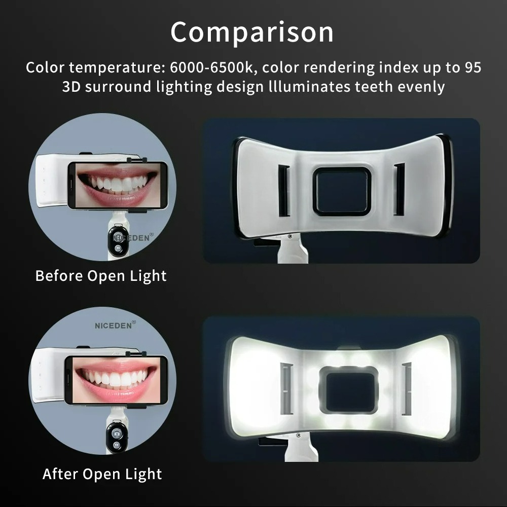 Lampu Fotografi Gigi untuk Pon - Photography Dental ulasan dan harga