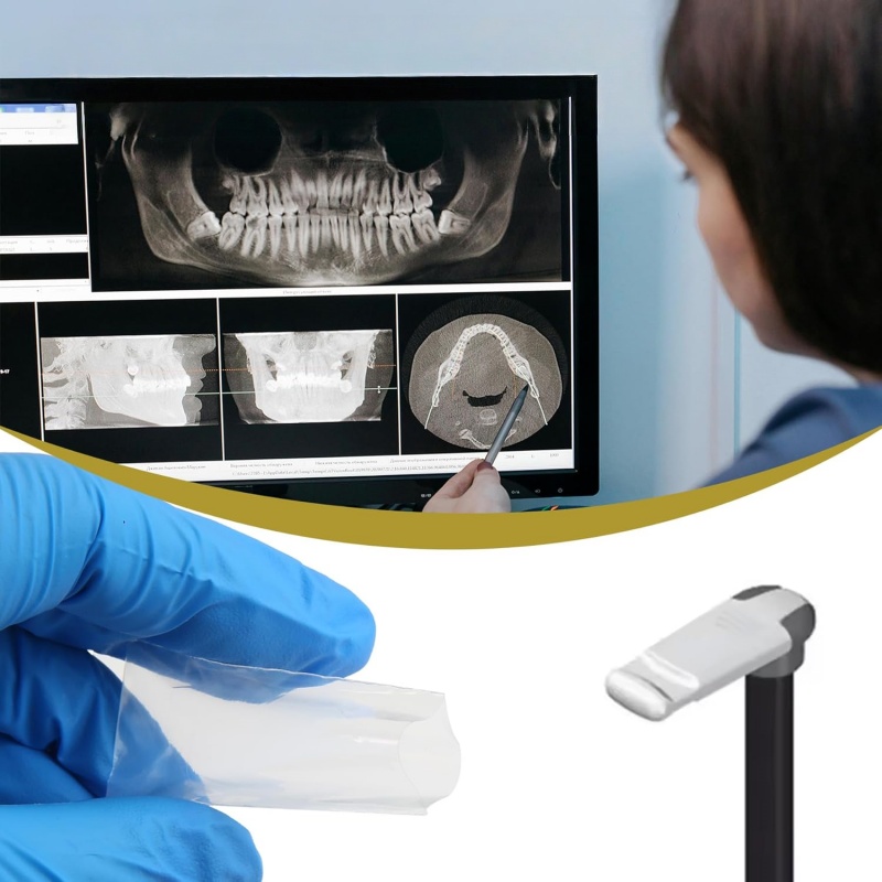 200Pcs/box Sarung Pelindung Gi - Photography Dental ulasan dan harga