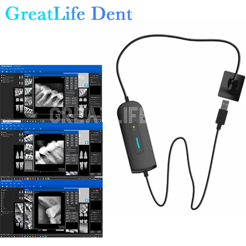Meksiko RU EU ES SA IT Tersedi - Photography Dental ulasan dan harga