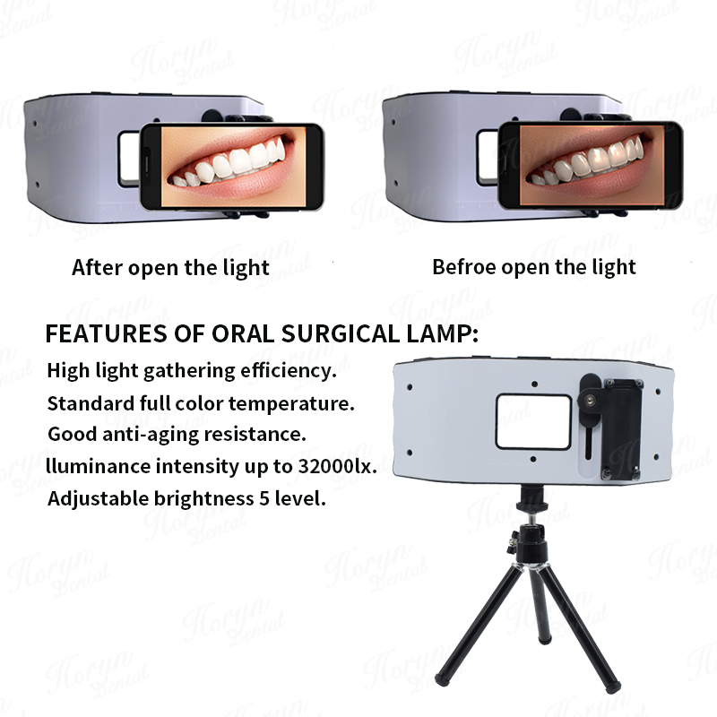 Lampu kilat gigi, peralatan fo - Photography Dental ulasan dan harga